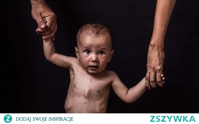 Serce Andrzejka prosi o pomoc! Musi być zoperowane