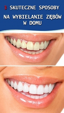 3 SKUTECZNE SPOSOBY NA WYBIELANIE ZĘBÓW W DOMU