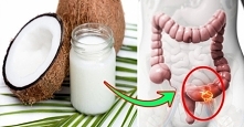 Lekarze są wstrząśnięci: olej kokosowy zabija 93% komórek raka okrężnicy