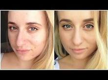 VICHY DERMABLEND: TEST NA ŻYWO