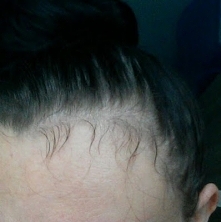 Sposób na wypadające włosy....