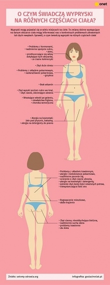 O czym świadczą wypryski na...