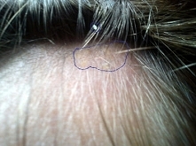 wygrałam z ŁZS! Szczegóły KLIK na zdjęcie:)