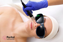 Nanobrazja - frakcyjny peel...