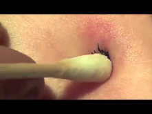 Usunięcie kleszcza bez użycia pęsety? To możliwe - pielęgniarka pokazuje prostą metodę.
Webniusy to zbiór najważniejszych wiadomości i historii z całego świata.