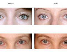 Speick – roślina o zbawiennym wpływie