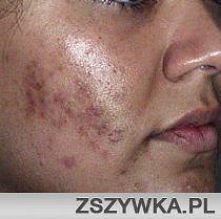 5 prostych sposobów, aby us...