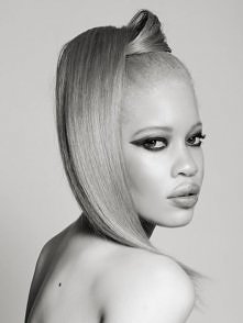 Diandra Forrest — albino Af...