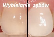 Domowy i sprawdzony sposób ...