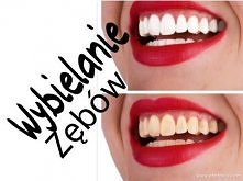 ♡ JAK WYBIELIĆ ZĘBY W DOMU ♡ WYBIELANIE KROK PO KROKU TANIM KOSZTEM