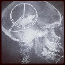 chomik mózgowy istnieje