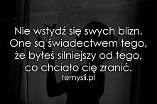 Nie wstydź się swoich blizn...