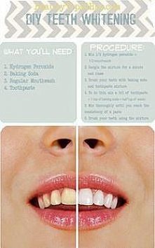 1. Wymieszać 1/2 wody utlenionionej + 1/2 do płukania jamy ustnej 2. płukać mieszaninę przez minutę i spłukać 3. Myć zęby z sody oczyszczonej i mieszaniny pasty do zębów 4, aby ...