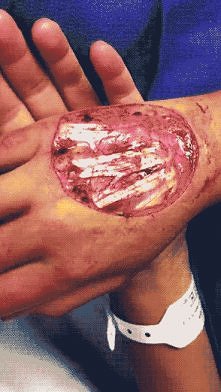 A więc tak wyglądają mięśni...