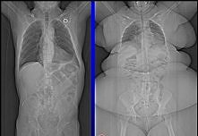 Nie rób sobie wymówek-wcale...