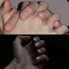 Jest to efekt po kuracji odżywką Eveline 8w1.
Odżywka sprawdzała się super, po odstawieniu (po prostu nie mam czasu na malowanie paznokci - i jak widać wypiłowanie) nie ma żadne...