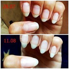 ;) kuracja z odżywką "...