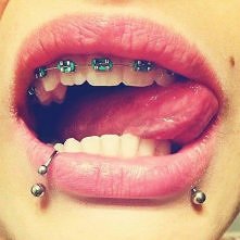 ..............................