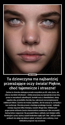 fajnie to wygląda ale nie chciałabym zachorować