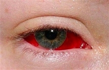 TO STRASZNE, co oni zrobili sobie z oczami.