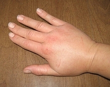 Herbata z mniszka lekarskiego
3#:Mniszek lekarski-retencja wody.jpg

Roślina słynąca ze swoich oczyszczających właściwości, którą można spożywać zarówno w postaci herbaty, jak i...