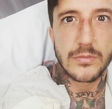 Austin ❤ juz po operacji