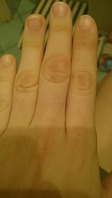 pomocy co zrobić!  na zgiec...