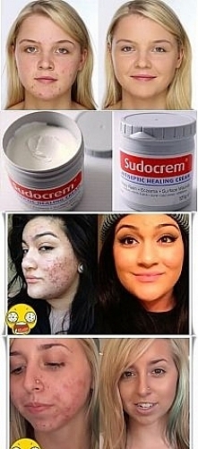 Oprócz swojego pierwotnego ...