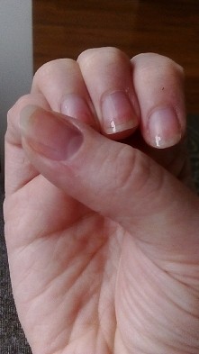 dziewczyny! znacie jakiś produkt który wybieli Mi końcówki moich paznokci?  Są w tragicznym stanie, potrzebuję porządnego środka na usunięcie skórek i na wybielenie moich paznok...