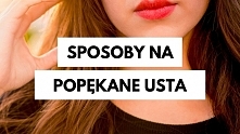 Sposoby za popękane usta!

KLIK W OBRAZEK