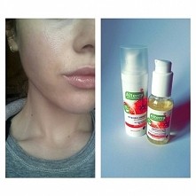 Naprawdę polecam! 
Dwa tygodnie temu do pielengnacji twarzy wlaczylam olejek oraz serum z Alterra do cery suchej. Efekty są świetne, moja sucha skóra jest nawilżona, niedoskonał...