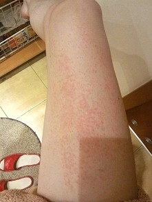 Pomocy :( zawsze po goleni...