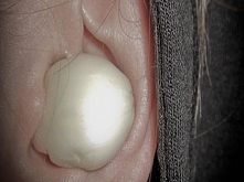 To się stanie, kiedy umieścisz ząbek czosnku w uchu