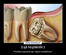 zszywki, usunęłam wczoraj z...