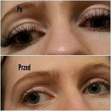 rzęsy