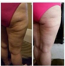 Wystarczy, że będziesz to robić codziennie, regularnie i nie będziesz mieć cellulitu!