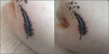 Czy jest tu jakaś osoba doświadczona z tatuażami? Zrobiłam sobie tatuaż w sobotę, niestety tusz jakby odpadał ze skórą. Skóra tam gdzie jest tatuaż popękała i odchodzi, z nią tu...