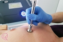 Mikrodermabrazja diamentowa - jak przebiega?