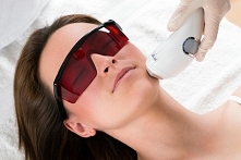 Laser frakcyjny - wskazania i przeciwwskazania