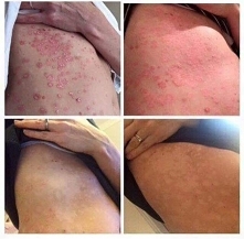 Zbieram zamówienia na kapsulki jagodowe wzmacniające włosy i paznokcie, zwalczające problemy skórne i cellulit‼️
Kto ma ochotę? 