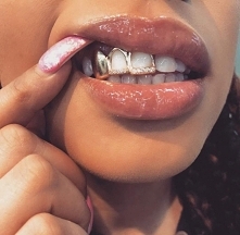 women, lips, white, teeth, gold, grillz