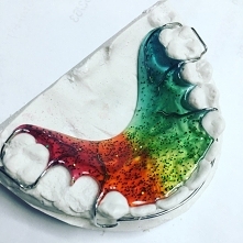 Płytka retencyjna. Kolejne zlecenie na tęczowy ale tym razem z brokatem :-) Miłego Kochani 