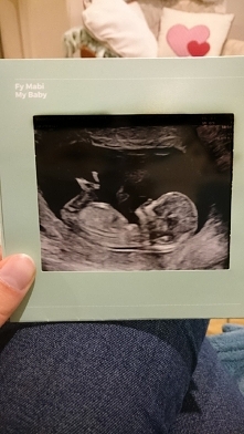 Pierwsza ciąża pierwsze zdj...