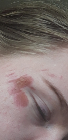 Wrzucam nieco drastyczne zdjęcie rany. To otarcie po upadku. W sobotę mam bardzo ważną imprezę.  Proszę polećcie mi coś co przyspieszy proces gojenia. Tylko nie aloes, bo to juz...