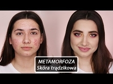 Metamorfoza 