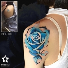 Cover czyli przykrycie starego tatuażu. Niebieska róża tatuaż. Niepodległe Studio Tatuażu Mokotusz. mokotusz.pl