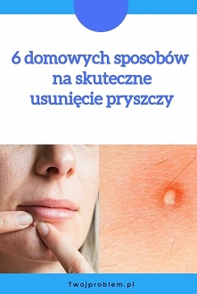 6 domowych sposobów na skut...