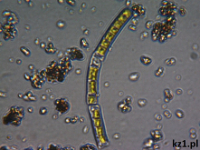 Oto jak wyglądają okrzemki pod mikroskopem.